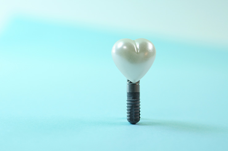 患者さまの負担に配慮した4Sコンセプト治療