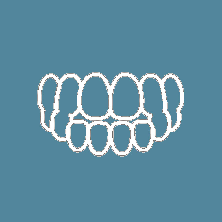 スリープスプリント